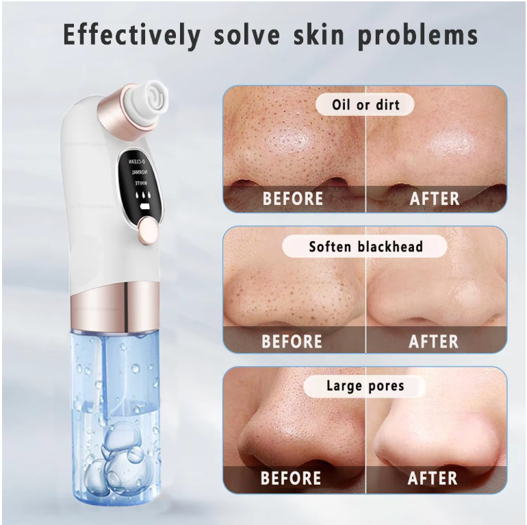 Pore Vacuum Face Cleaner